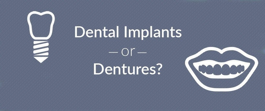 Dental Implants or Dentures?