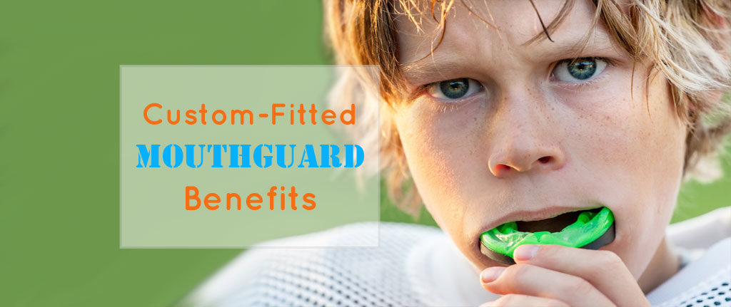 Custom-Fitted Mouthguard Benefits
